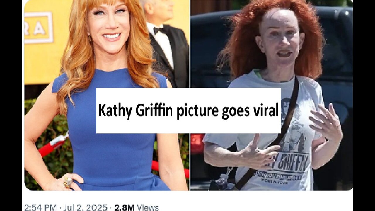 Kathy Griffin picture goes viral with Trump Derangement Syndrome