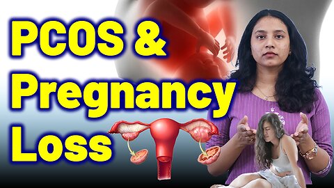 Link Between PCOS and Miscarriage, Failed Pregnancy, Early Pregnancy Loss. | Treatment Cure Medicine