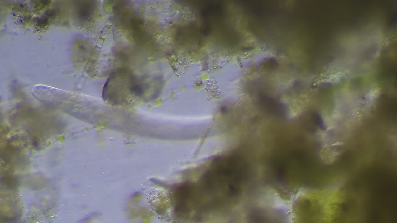 Flat Worm and Filament Algae