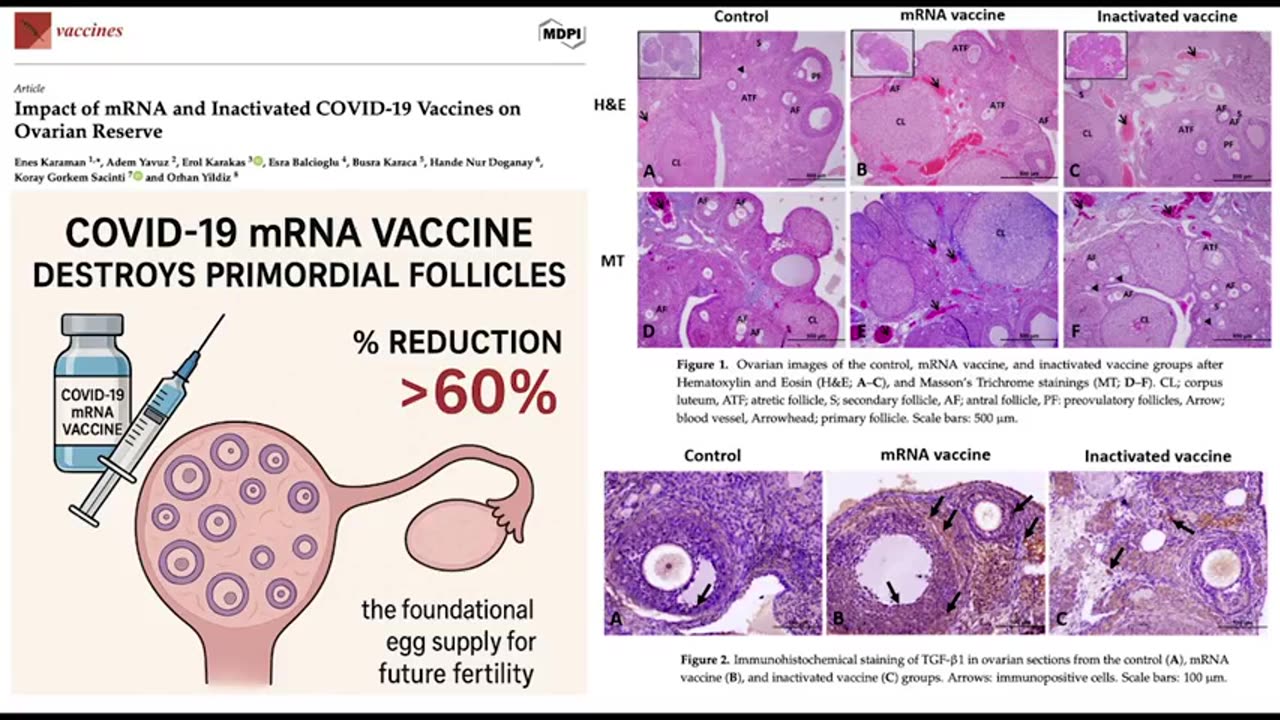 EyesIsWatchin #182 – Trump’s Gaza Freedom Zone, AI Neural Enslavement & Diddy’s Trial Theatre