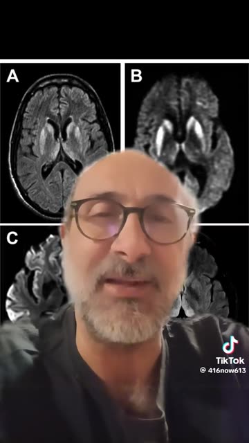 New Brunswick health zones and case distribution
