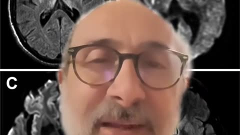 New Brunswick health zones and case distribution