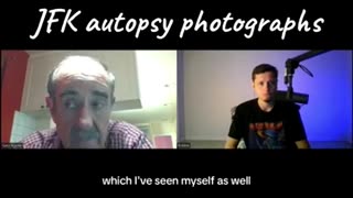 John Stringer & the Missing JFK autopsy photographs--WHERE is the Pic of the Right Side? Dr Aguilar