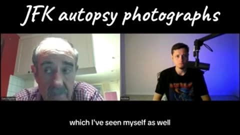 John Stringer & the Missing JFK autopsy photographs--WHERE is the Pic of the Right Side? Dr Aguilar