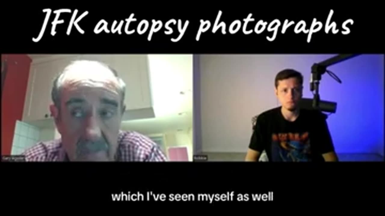 John Stringer & the Missing JFK autopsy photographs--WHERE is the Pic of the Right Side? Dr Aguilar