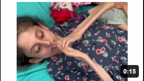 Hunger is devouring the bodies of Palestinians in Gaza 🇵🇸