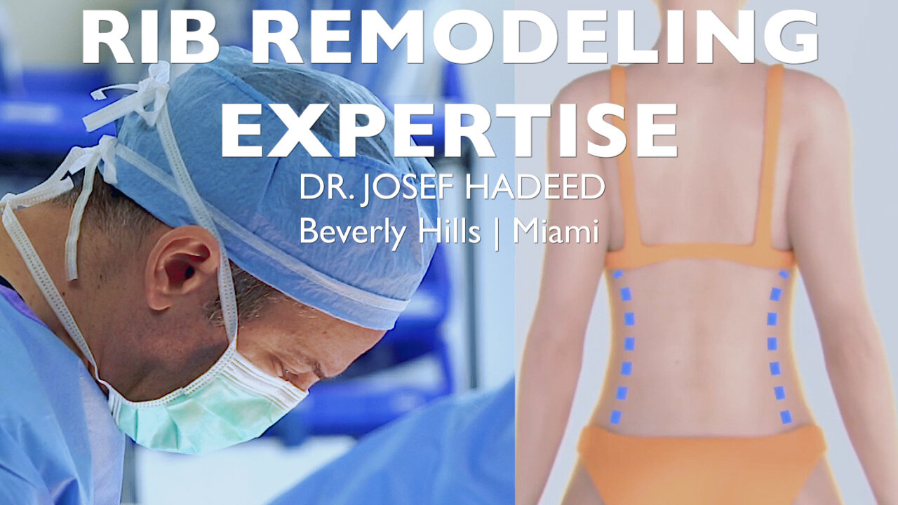 Dr. Hadeed is the Rib Remodeling Expert