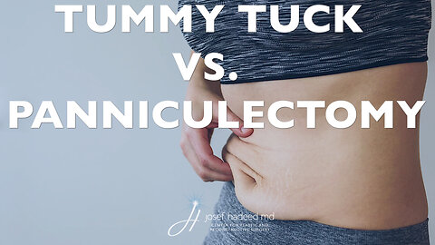 Tummy Tuck vs Panniculectomy