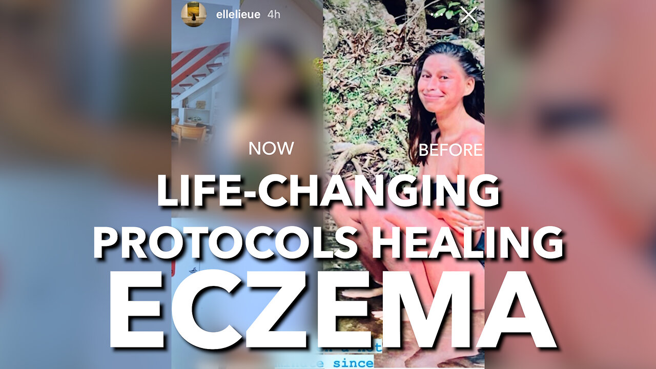 Life-Changing Protocols Healing Eczema