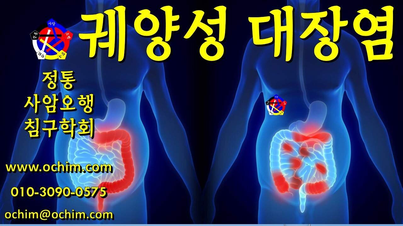 궤양성 대장염 치료 후기와 치료 방법 - 사암오행침, 사암침법, 오행침, 정통사암침
