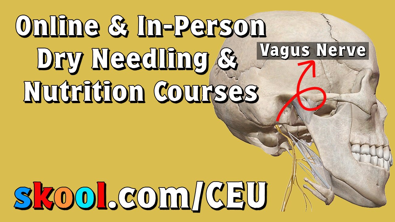 Vagus Nerve Stimulation for Migraine Headache Relief (Part 2)