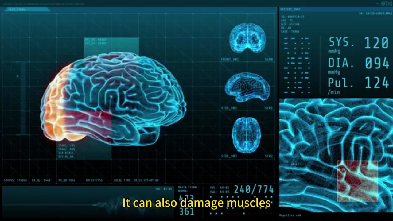 肌少與抑鬱 破解惡性循環