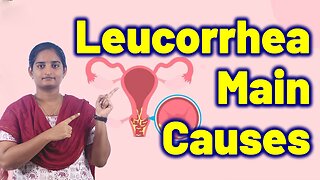Main Causes of Leucorrhea in Women | White Discharge Treatment Cure Medicine | Gynaecology Women