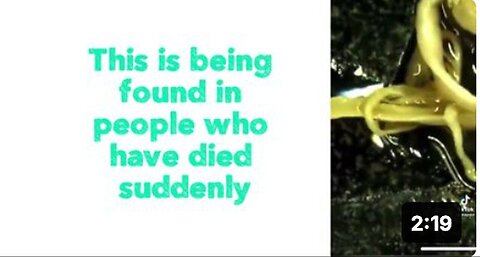"Unveiling the Mysterious Findings in Sudden Death Cases: An Unexpected Revelation"