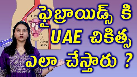 ఫైబ్రాయిడ్స్ UAE చికిత్స ఎలా చేస్తారు? Fibroids Uterine Artery Blocking or Embolization Procedure
