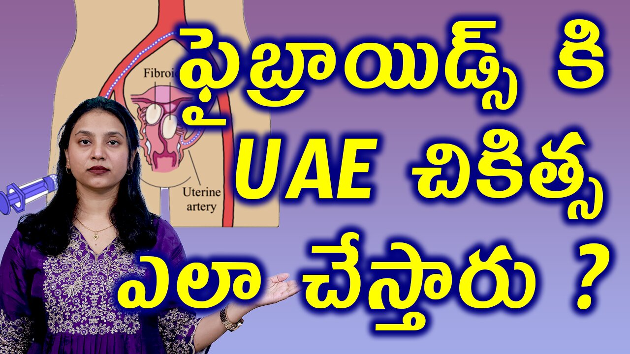 ఫైబ్రాయిడ్స్ UAE చికిత్స ఎలా చేస్తారు? Fibroids Uterine Artery Blocking or Embolization Procedure