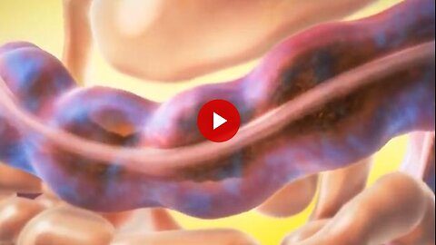 Easy Digestive Problems Fix (Works For Anyone)....