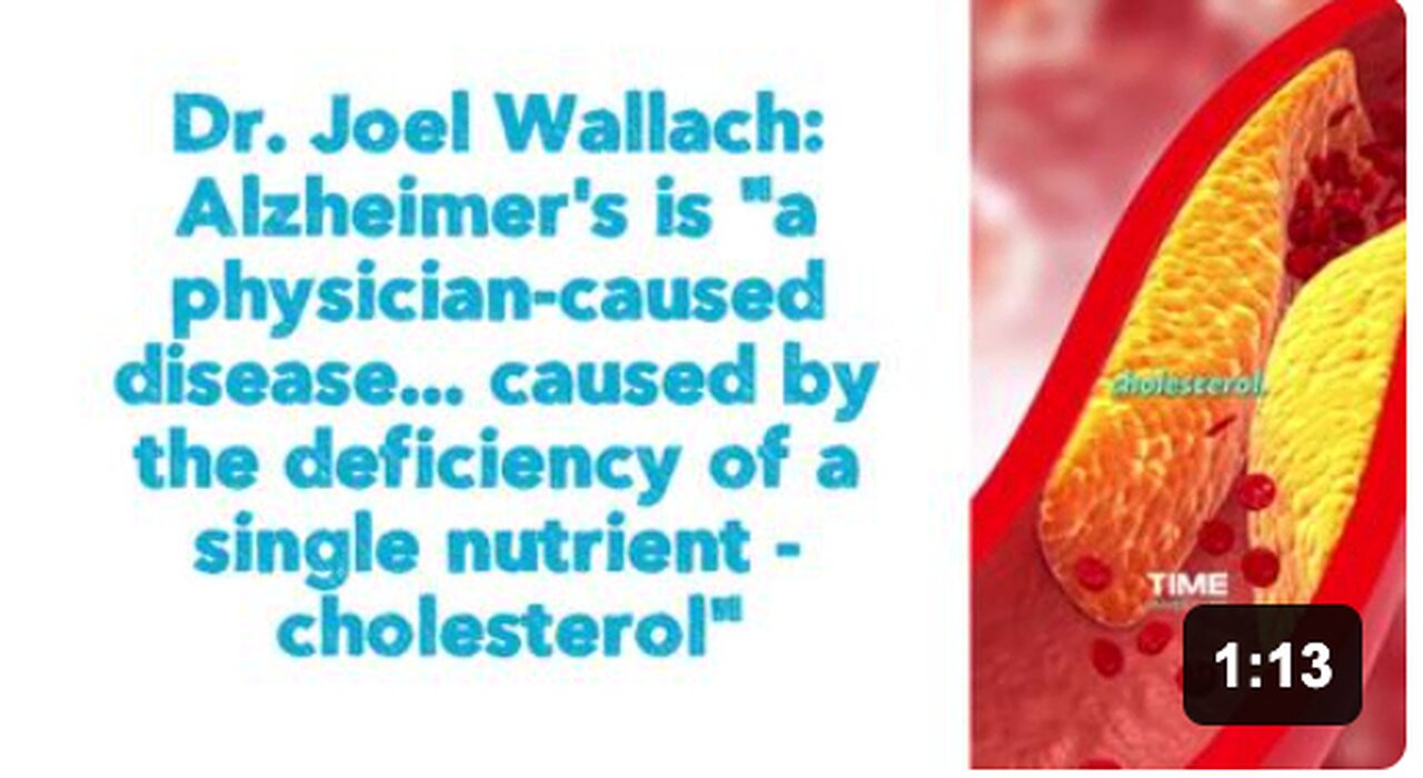 Dr. Joel Wallach: Alzheimer's is "a physician-caused disease... caused by the deficiency of a single nutrient - cholesterol"