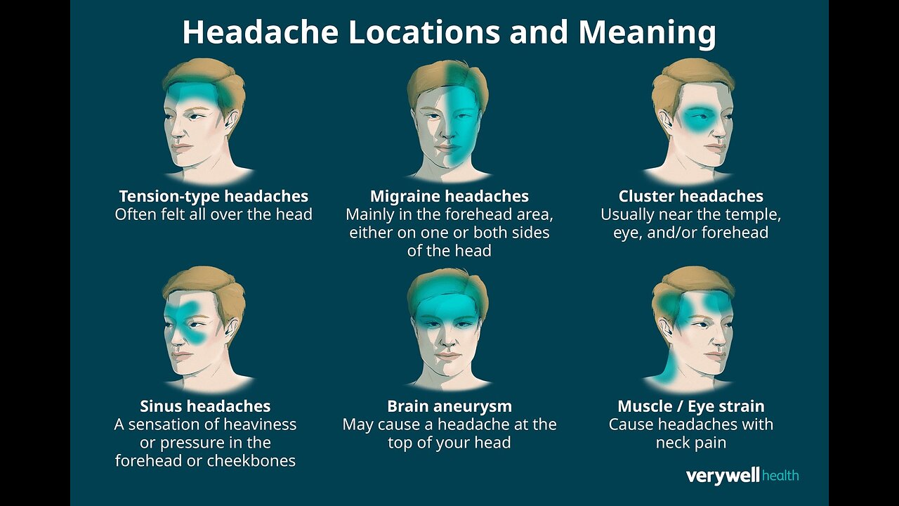 Facts regarding headaches