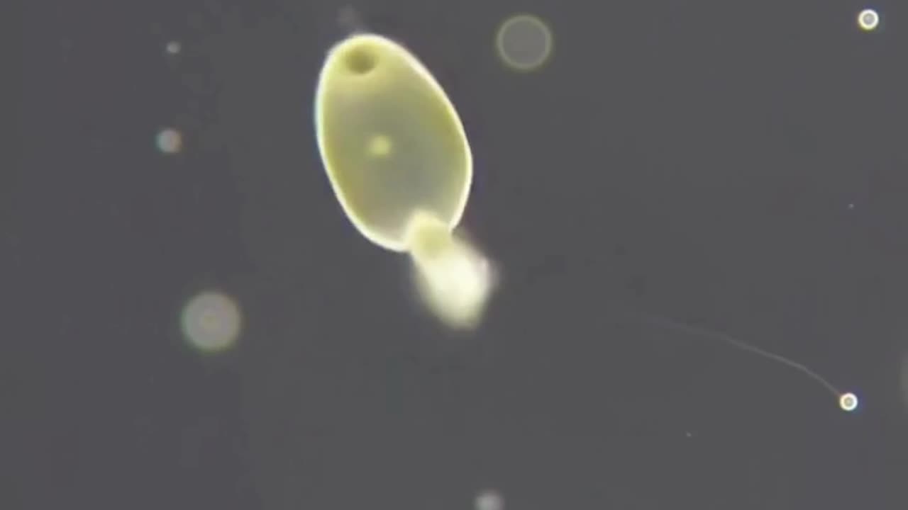 🧬 ICSI: Intracytoplasmic Sperm Injection 🧬