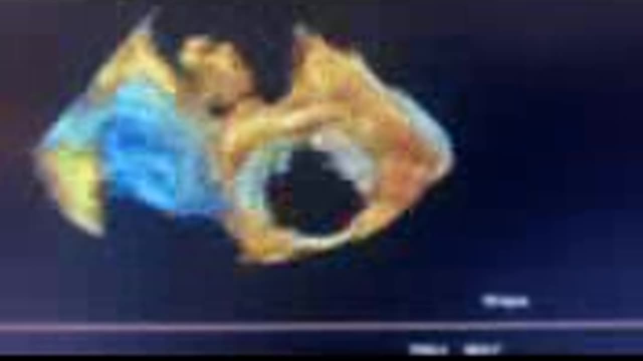 What is a myxoma?