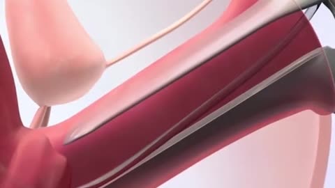 In Vitro Fertilization (IVF) Process 3D Animation