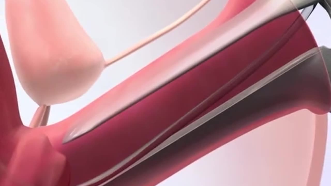 In Vitro Fertilization (IVF) Process 3D Animation