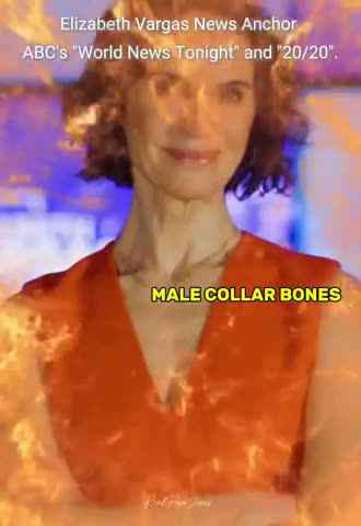 EGI: ABC Elizabeth Vargas Clavicle Club #2