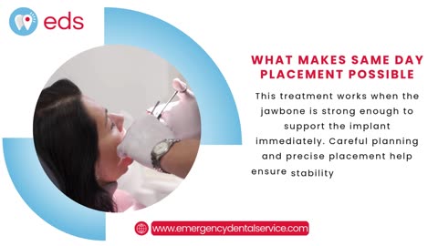 Same Day Dental Implants - What Happens in One Visit | Emergency Dental Service