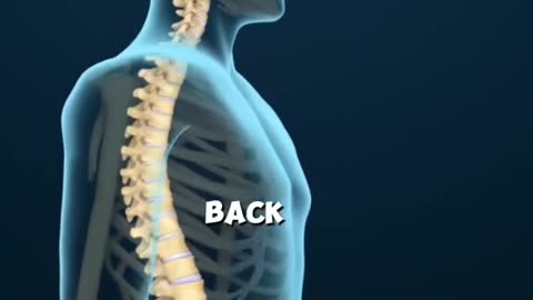 Back Surgery - Lumbar Disc Replacement