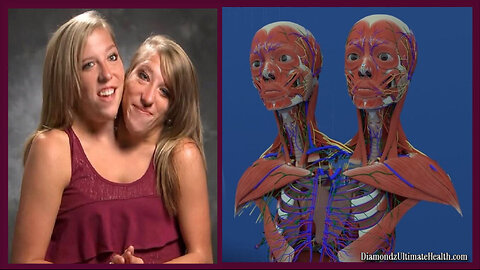 💦 HEALTH WATCH: 👯🏻‍♀️ The 3D Anatomy of Conjoined Twins Brittany and Abbey Hensel ♡ Fascinating!