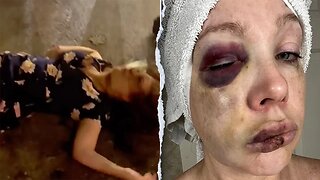 Does DOJ Keep Victims Quiet About Black Crime?