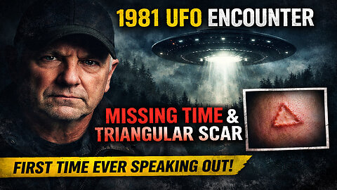 First-Ever Interview: Michigan Experiencer’s 1981 UFO Encounter & Unexplained Scar | Doug Wilgocki