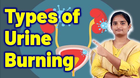 Types of Urine Burning in Women Body | Urinary Urethritis Infection Treatment | Homeopathy, Medicine