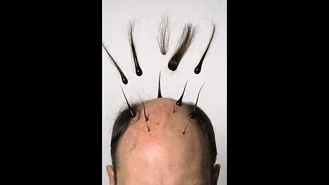 Human hair 3D Animation #3dmedico