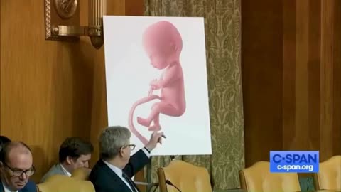 Senator John Kennedy owns abortionists