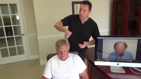 Dr. Brett Bolton Hair Transplant – Nathan’s One-Year Follow-Up