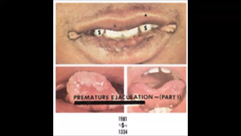 Premature Ejaculation - Part 1 - Track 4 (1981)