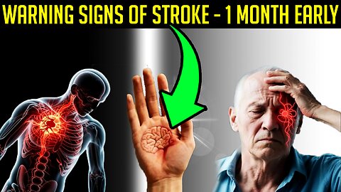 Health Alert 7 symptoms that many people ignore but signal a stroke 1 month in advance.