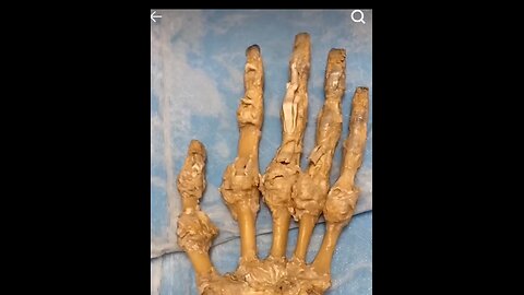 how fingers moves in real#bone#BoneHealth#BoneCare#StrongBones#BoneStrength#BoneHealing#BoneInjury