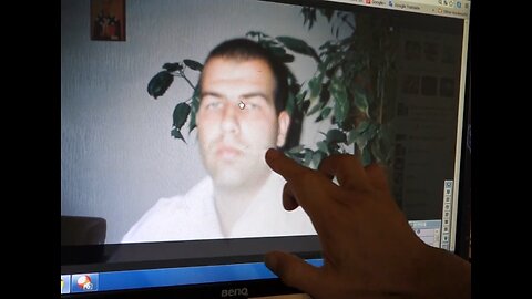 Luodong Gives Online Treatment To Man With Nose Trouble