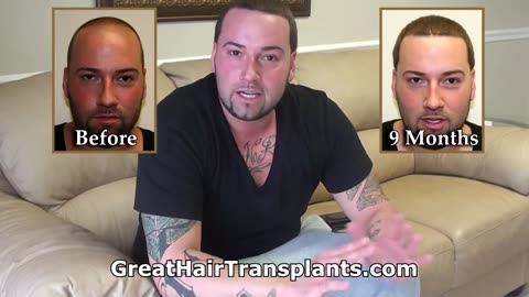 Young Man’s Hair Growing Like Weeds After Dr. Brett Bolton’s Hair Transplant