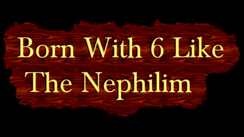 Born With "6" Just Like The "NEPHILIM" Some Say The Fallen...