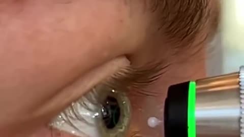 Tonometry is a test to measure eye pressure and detect early signs of glaucoma.