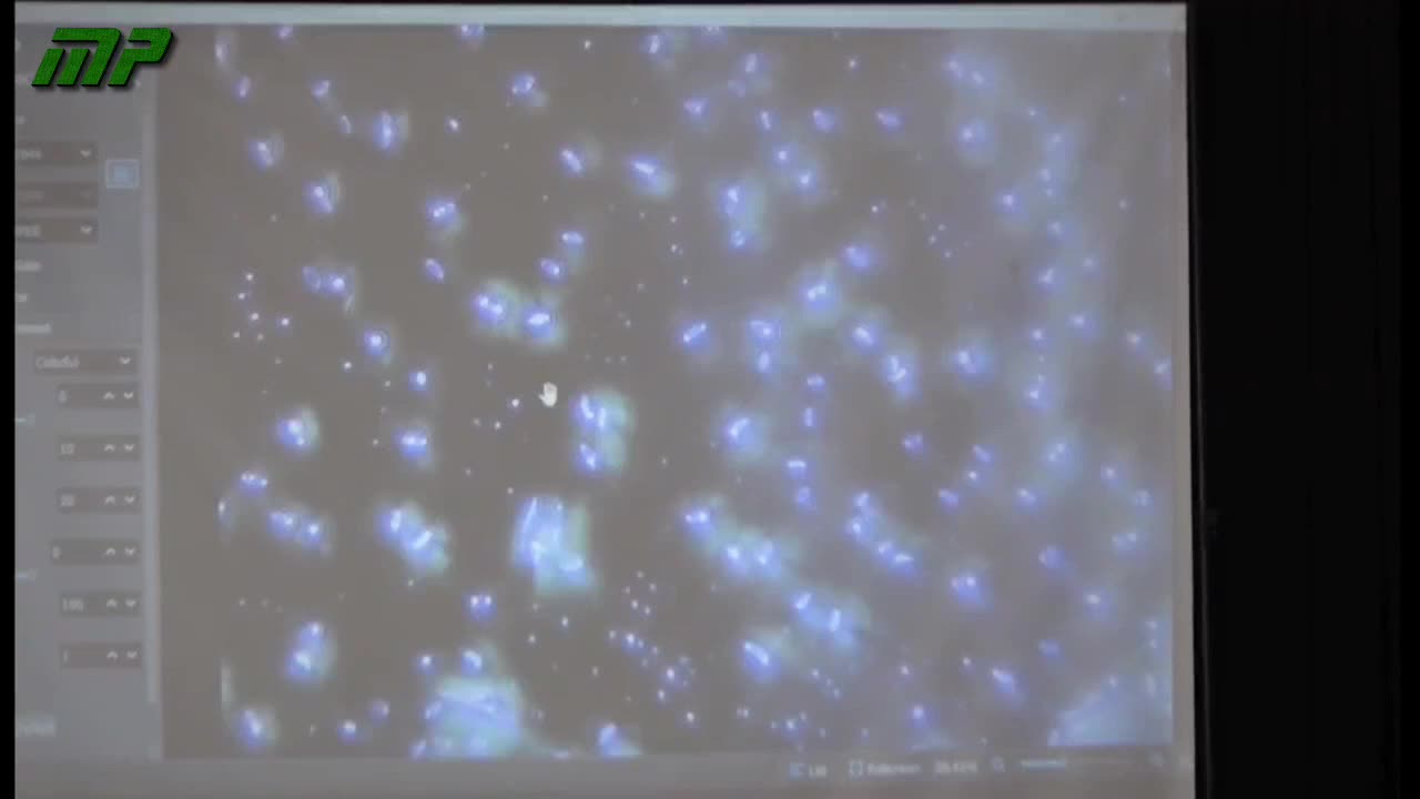 Denuncia por envenenamiento con "vacunas" en Argentina (18 de Junio del 2025)