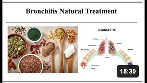 Bronchitis Natural Treatment Options