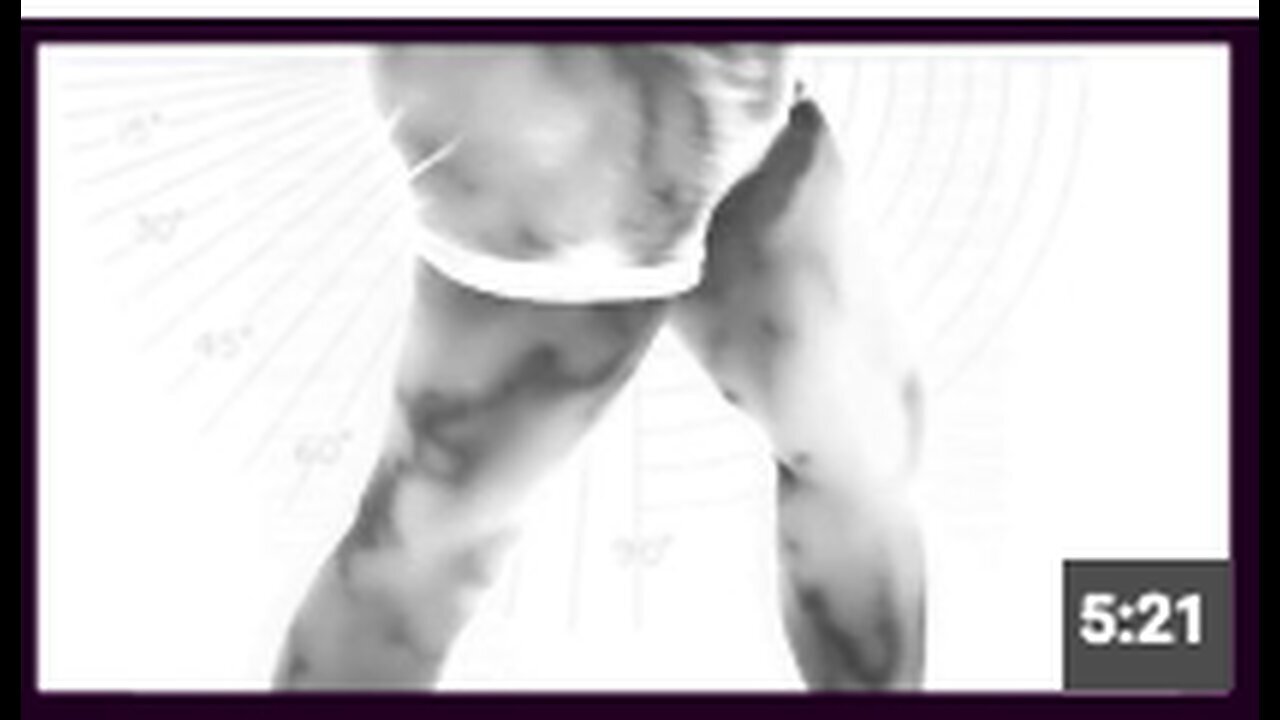 "Asymptomatic Vaccinated Individuals Display Large Blood Clots in Thermographic Imaging"