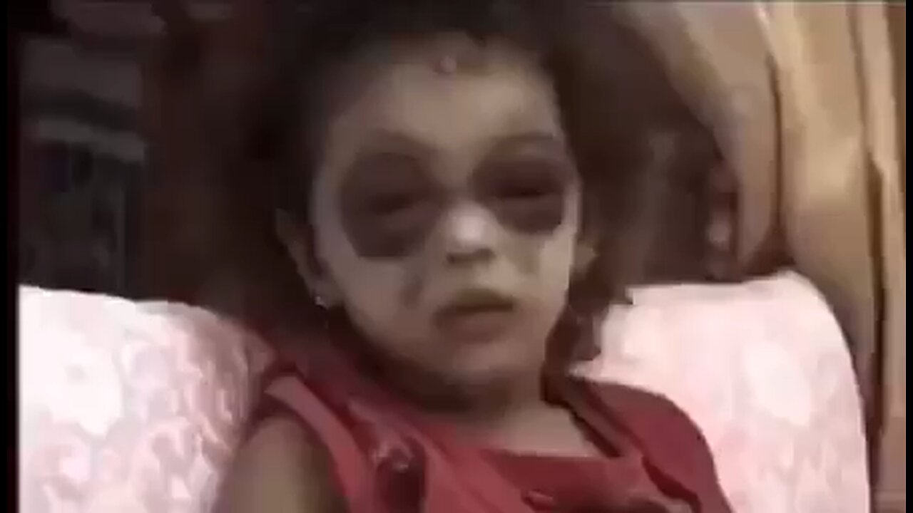 Open your eyes. Pain is coming