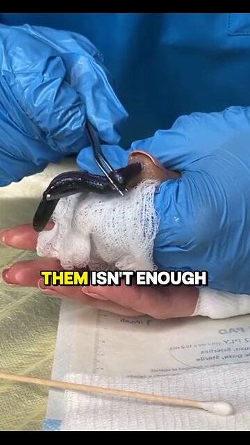 Eliminate Parasites + Flush Toxins Fast! 😲