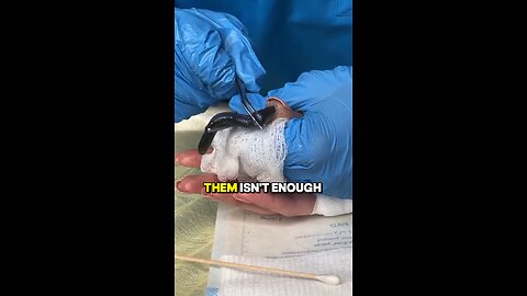 Eliminate Parasites + Flush Toxins Fast! 😲